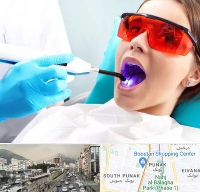 جراحی لثه با لیزر در پونک 