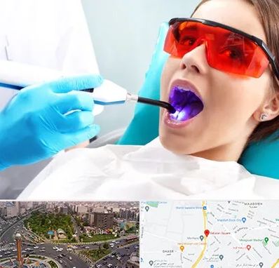 جراحی لثه با لیزر در سبلان