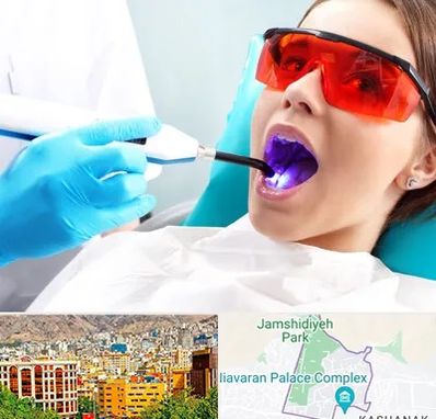 جراحی لثه با لیزر در نیاوران 