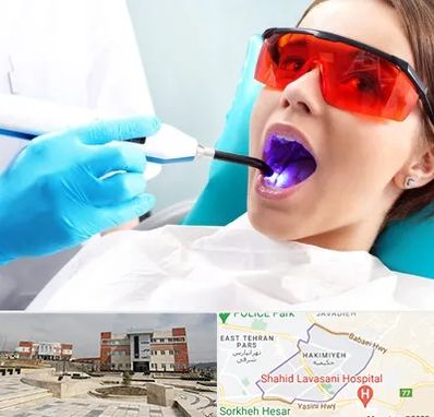 جراحی لثه با لیزر در حکیمیه 