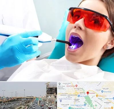 جراحی لثه با لیزر در بلوار توس مشهد