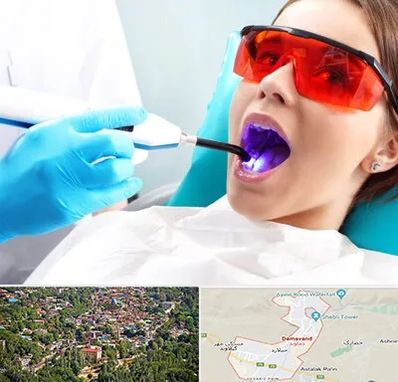 جراحی لثه با لیزر در دماوند