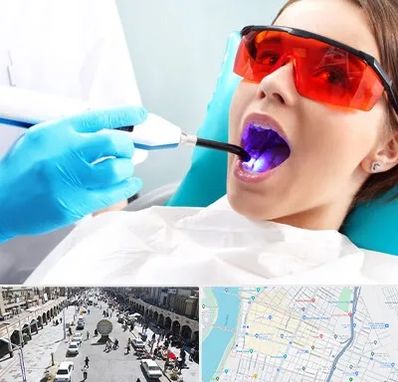 جراحی لثه با لیزر در نادری اهواز