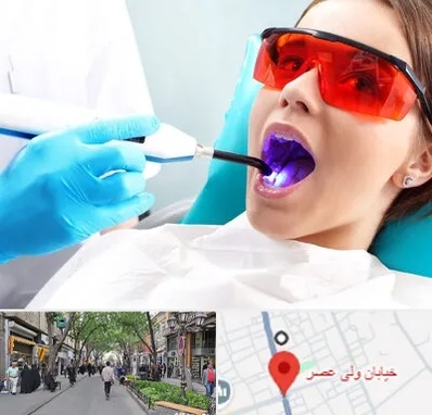 جراحی لثه با لیزر در ولیعصر شهریار