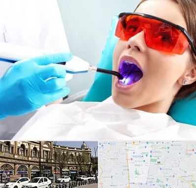 جراحی لثه با لیزر در منطقه 11 تهران