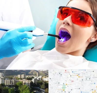 جراحی لثه با لیزر در دیباجی