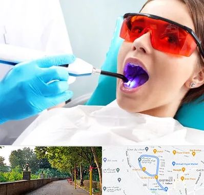 جراحی لثه با لیزر در فلکه گاز رشت