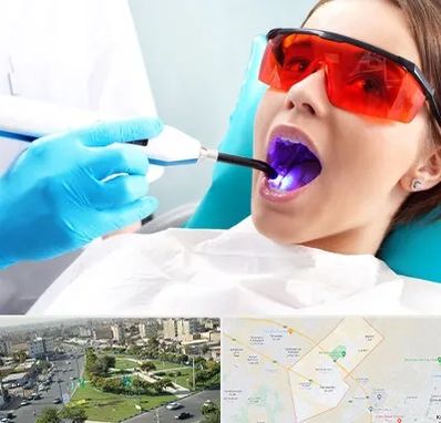 جراحی لثه با لیزر در کمال شهر کرج