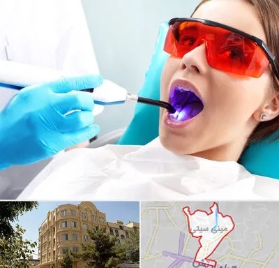 جراحی لثه با لیزر در مینی سیتی