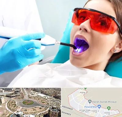 جراحی لثه با لیزر در پرند