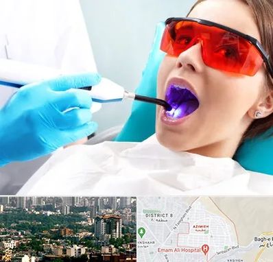 جراحی لثه با لیزر در عظیمیه کرج 