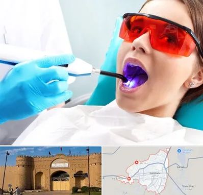 جراحی لثه با لیزر در ایرانشهر