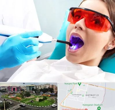 جراحی لثه با لیزر در تهرانسر 