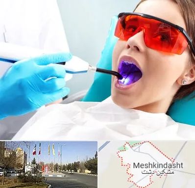 جراحی لثه با لیزر در مشکین دشت