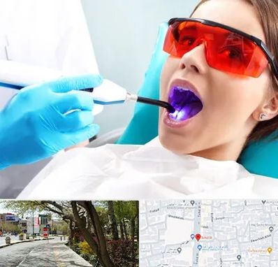 جراحی لثه با لیزر در خیابان توحید اصفهان