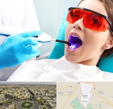 جراحی لثه با لیزر در قزوین