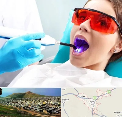 جراحی لثه با لیزر در بیجار