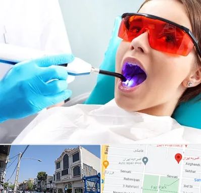 جراحی لثه با لیزر در افسریه 