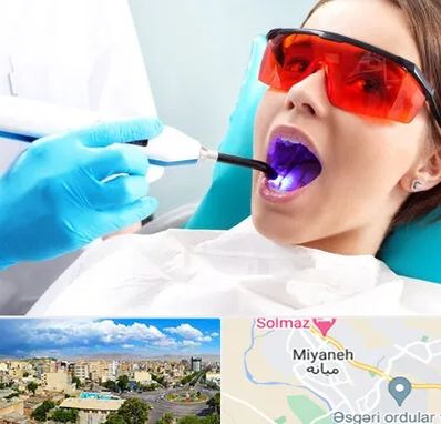 جراحی لثه با لیزر در میانه