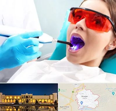 جراحی لثه با لیزر در برازجان