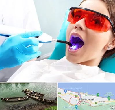 جراحی لثه با لیزر در بندر انزلی