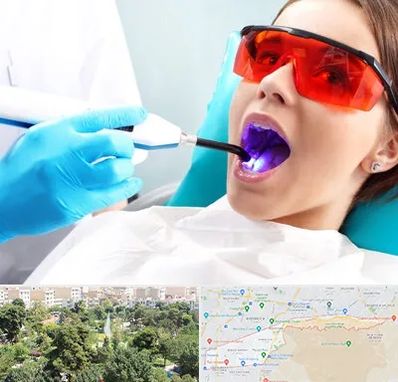 جراحی لثه با لیزر در منطقه 13 تهران