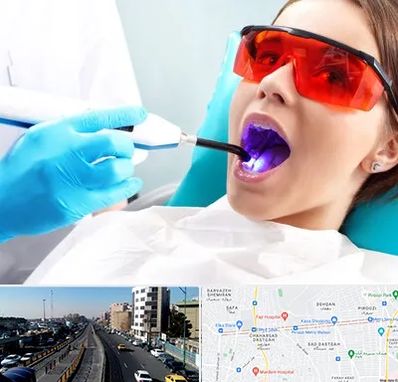 جراحی لثه با لیزر در پیروزی 