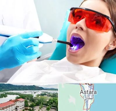 جراحی لثه با لیزر در آستارا