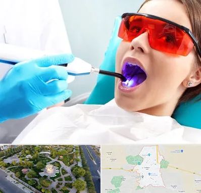 جراحی لثه با لیزر در کاشمر