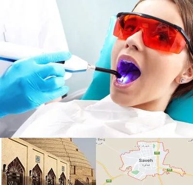 جراحی لثه با لیزر در ساوه