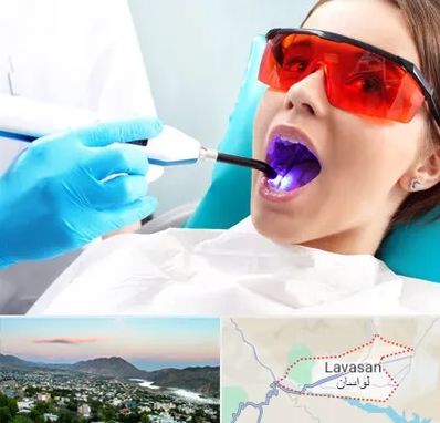جراحی لثه با لیزر در لواسان