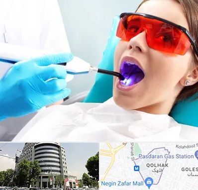 جراحی لثه با لیزر در قلهک 