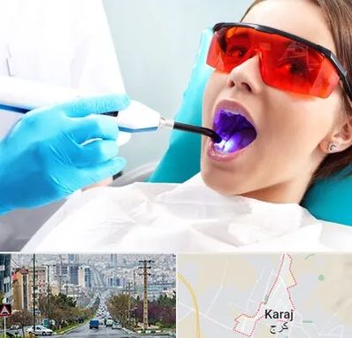 جراحی لثه با لیزر در گوهردشت کرج 