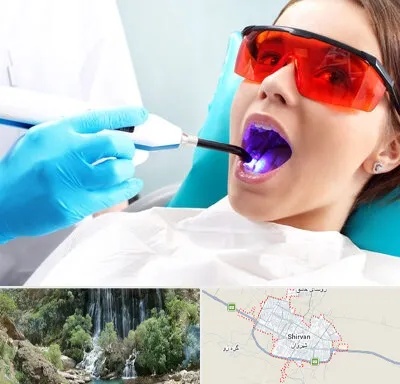 جراحی لثه با لیزر در شیروان