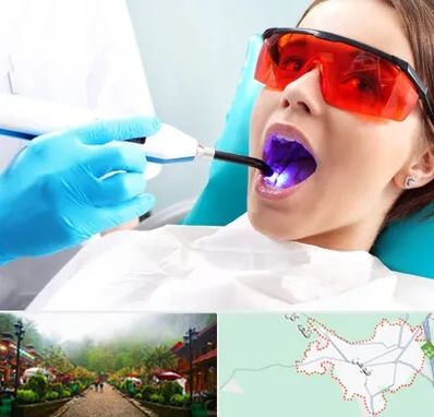 جراحی لثه با لیزر در فومن