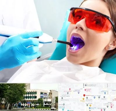 جراحی لثه با لیزر در طالقانی