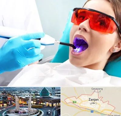 جراحی لثه با لیزر در زنجان