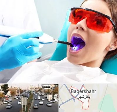 جراحی لثه با لیزر در باقرشهر