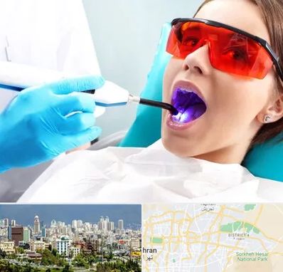 جراحی لثه با لیزر در شرق تهران 