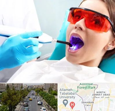 جراحی لثه با لیزر در شهران 