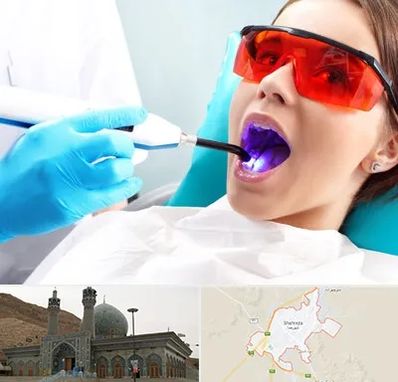 جراحی لثه با لیزر در شهرضا