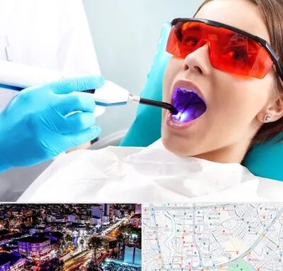 جراحی لثه با لیزر در منظریه رشت