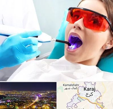 جراحی لثه با لیزر در کرج