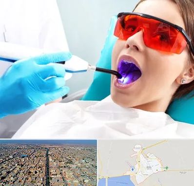 جراحی لثه با لیزر در بندر ماهشهر