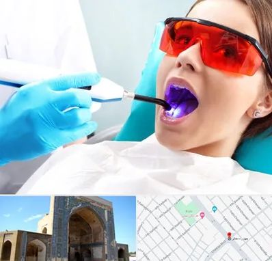 جراحی لثه با لیزر در مصلی مشهد