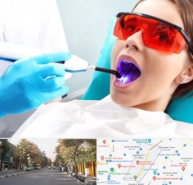 جراحی لثه با لیزر در شریعتی 