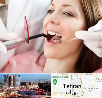 متخصص درمان ریشه دندان در صادقیه 