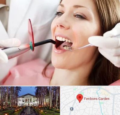 متخصص درمان ریشه دندان در باغ فردوس