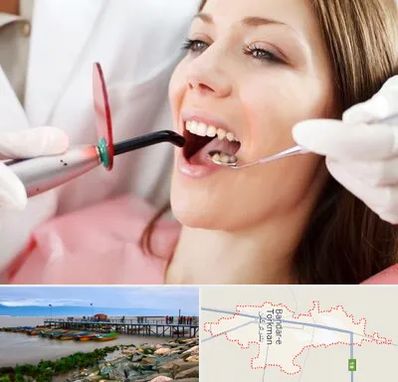 متخصص درمان ریشه دندان در بندر ترکمن