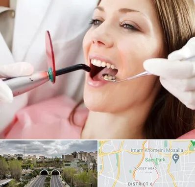 متخصص درمان ریشه دندان در یوسف آباد 